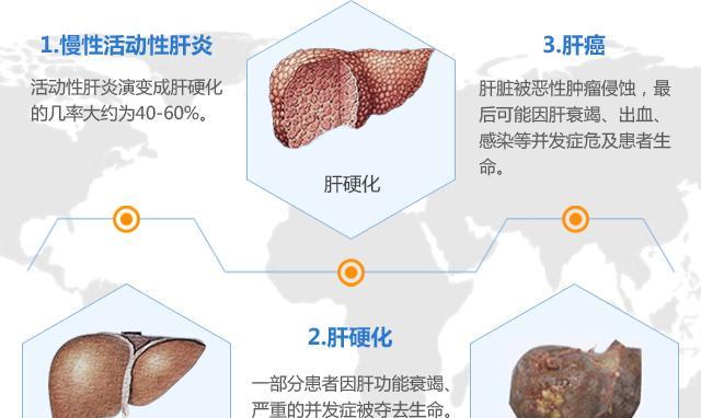 肝硬化早期的三大症状及其预防与治疗（早期肝硬化的症状分析）