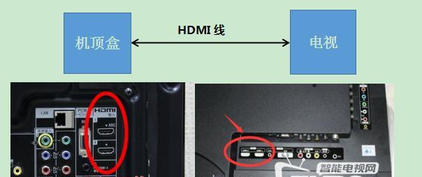 投影仪怎么连接机顶盒？连接步骤是什么？